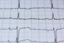 infinity stream business pulse